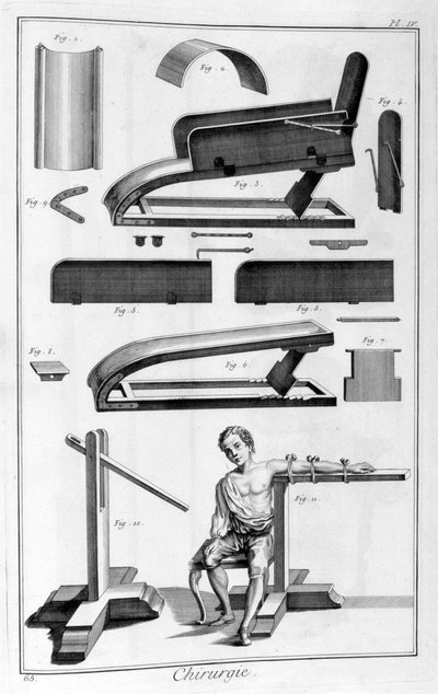 Kirurgi, 1751-1777 af Unbekannt