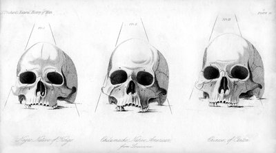 Tre typer af menneskeskalle, 1848 af Unbekannt