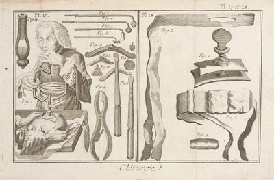 Trefination af Unbekannt