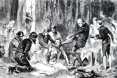 Ambroise Pare fjerner en lanse fra ansigtet på Duc due Guise. af Unbekannt