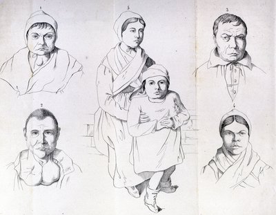 Overvejelser om årsagerne til endemisk kretinisme af Morel. af Unknown artist