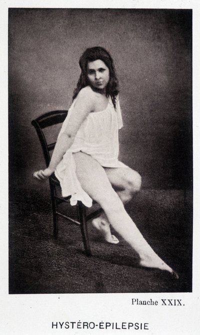 Hystero Epilepsie - Contracture in "" Fotografisk ikonografi af Salpétrière: service of Mr. Charcot" af Paul Regnard og Bourneville af Unknown artist