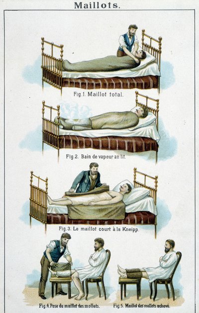 Trøjer: 1) Total trøje, 2) Dampbad i sengen, 3) Kneipp kort trøje, 4-5) Kalvetrøje - i "Bilz, Natural Medication", slutningen af 1800-tallet af Unknown artist