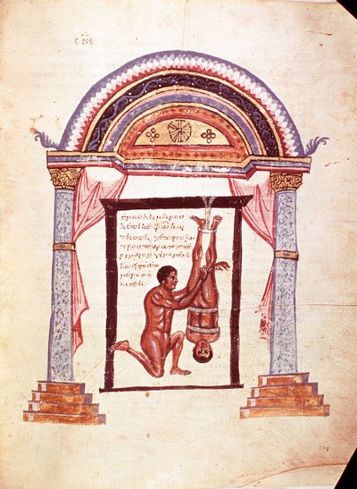 Medicin: reduktion af et forskudt knæ, patienten er suspenderet i fødderne (manuskript af Unknown artist