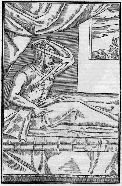 Næseoperation: Rekonstruktionskirurgi på næsen i “De curtorum chirurgia per insitionem””. Venedig af Unknown artist