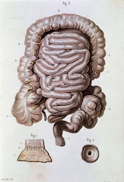 Undersøgelse af menneskelig tarm (tarm), tolvfingertarm og tyndtarm (gravering af Unknown artist