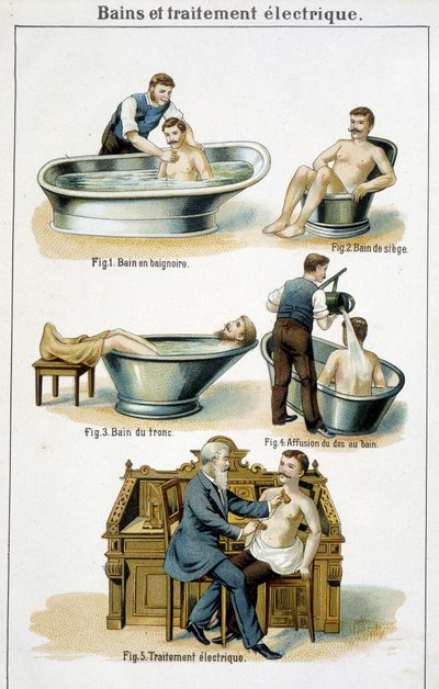 Bade og el-behandling: 1) Badekar, 2) Sædebadekar, 3) Bagagebad, 4) Tilbage til bad, 5) El-behandling - i "Bilz, Natural Medication", slutningen af 1800-tallet af Unknown artist
