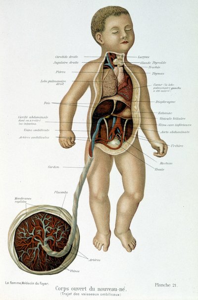 Medicin: nyfødt (afhudet i barmen). af Unknown artist