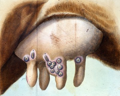 Koens bryst blev brugt til at inokulere koppevaccinen af Luigi Sacco (1769-1836) i januar 1801. Medicinsk plade fra "" Vaccination Treat" af Luigi Sacco, Milano af Unknown artist