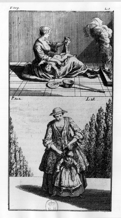 Behandlinger til børn - i "" Ortopædi eller kunsten at rette og rette op på kroppens vanskeligheder"", af M. Audry, rådmand for Kongen af Unknown artist