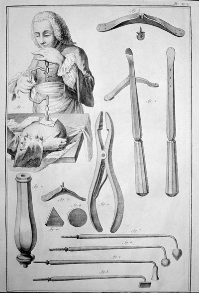 Trepanering af kraniet, forskellige instrumenter (gravering af Unknown artist