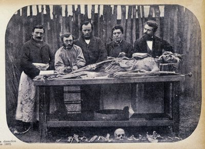 Dissektion, v.1865. af Unknown photographer