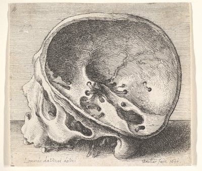 Sektioneret kranium i profil til venstre med venstre side af kraniet fjernet, 1651. af Wenceslaus Hollar