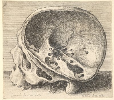 Sektioneret kranium i profil til venstre med venstre side af kraniet fjernet, 1651. af Wenceslaus Hollar