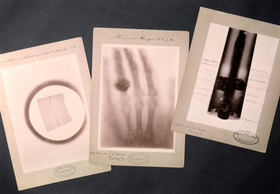 Originale røntgenbilleder af Roentgen, der viser (radiografi) af Wilhelm (after) Röntgen