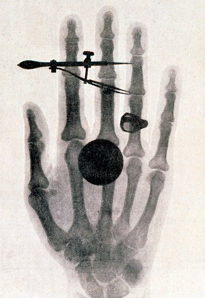 Wilhelm Roentgens røntgenfotografi af sin kones hånd, 1896 af Wilhelm Conrad Rontgen