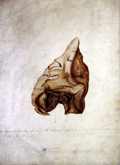 Study of Brain I, ca. 1850 (akvarel på papir) af William Lover