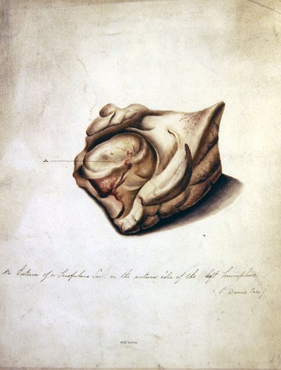 Study of the Brain II, ca. 1850 (akvarel på papir) af William Lover