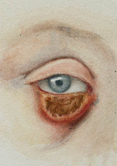 Øjne af Frederick (attr. to) Barnard