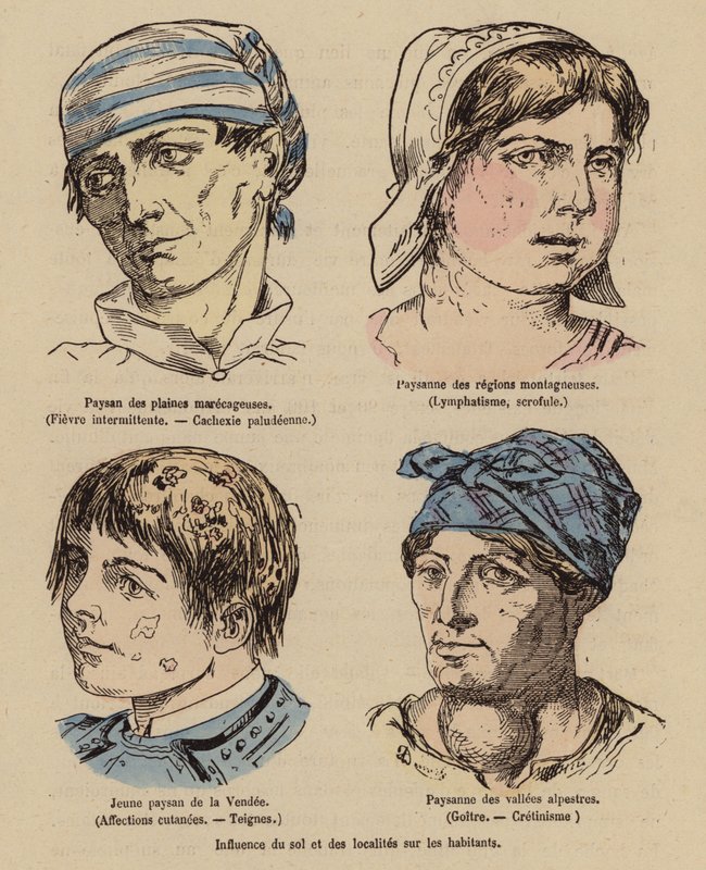 Solens og den geografiske placerings indflydelse på mennesker (koloreret stik) af (after) French School