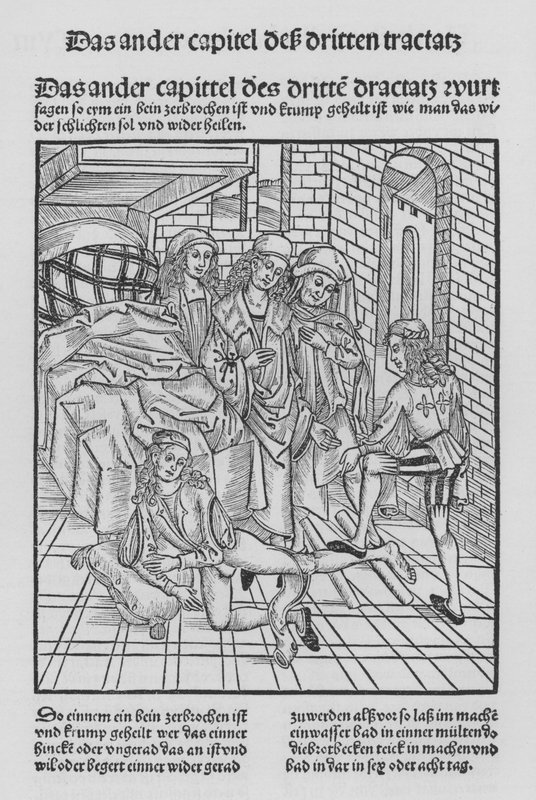 The Book of Cirurgia af Hieronymus Brunschwig (litho) af (after) German School