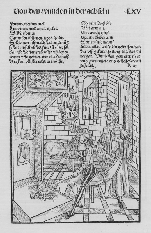 The Book of Cirurgia af Hieronymus Brunschwig (litho) af (after) German School