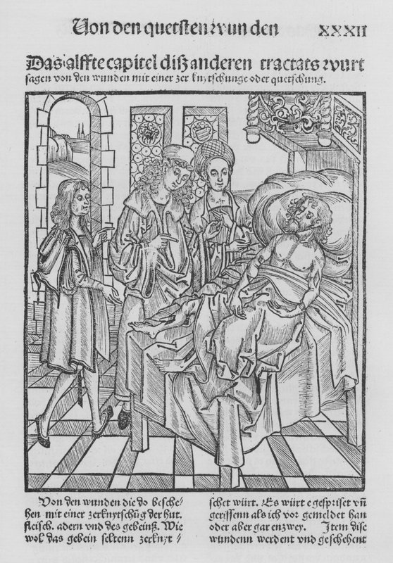 The Book of Cirurgia af Hieronymus Brunschwig (litho) af (after) German School