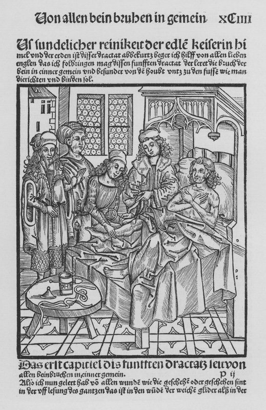 The Book of Cirurgia af Hieronymus Brunschwig (litho) af (after) German School