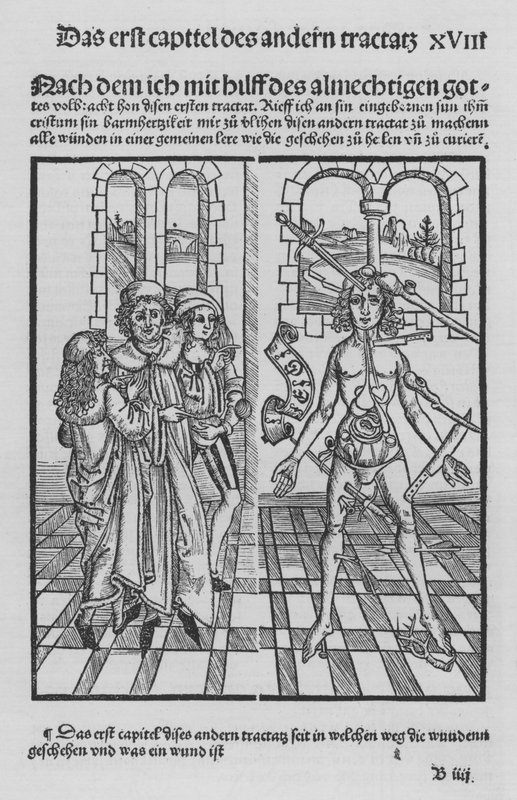 The Book of Cirurgia af Hieronymus Brunschwig (litho) af (after) German School