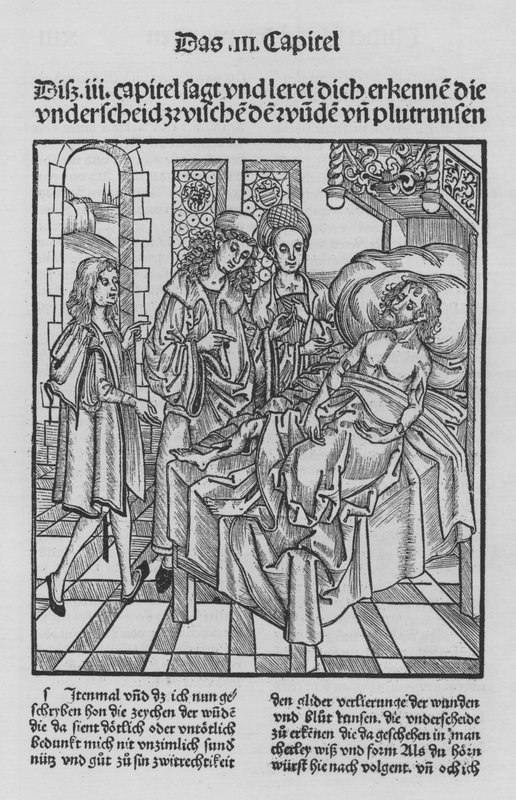 The Book of Cirurgia af Hieronymus Brunschwig (litho) af (after) German School