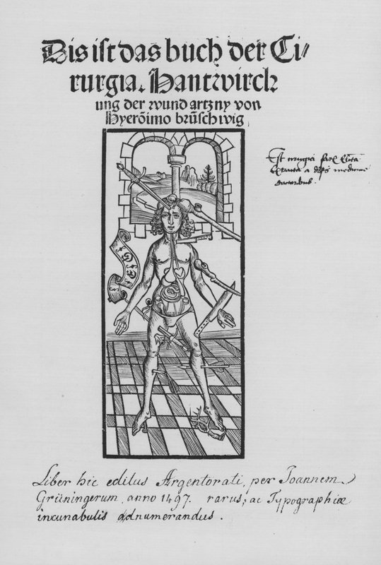The Book of Cirurgia af Hieronymus Brunschwig (litho) af (after) German School