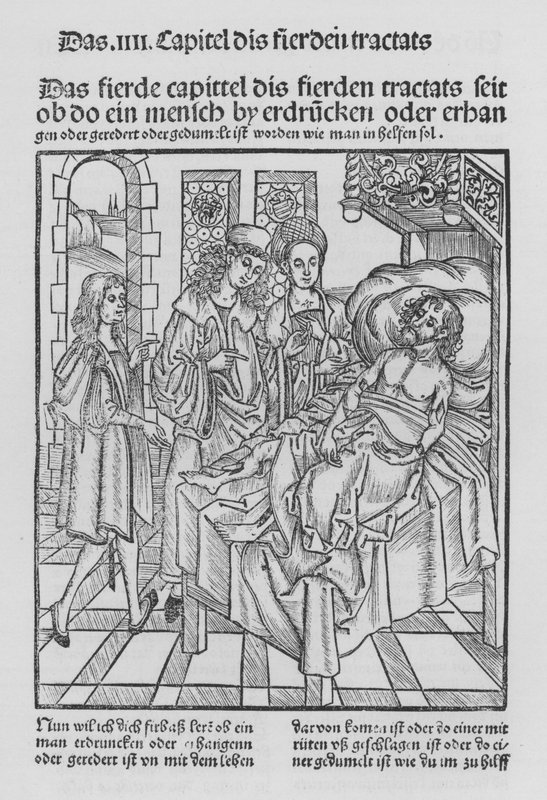 The Book of Cirurgia af Hieronymus Brunschwig (litho) af (after) German School
