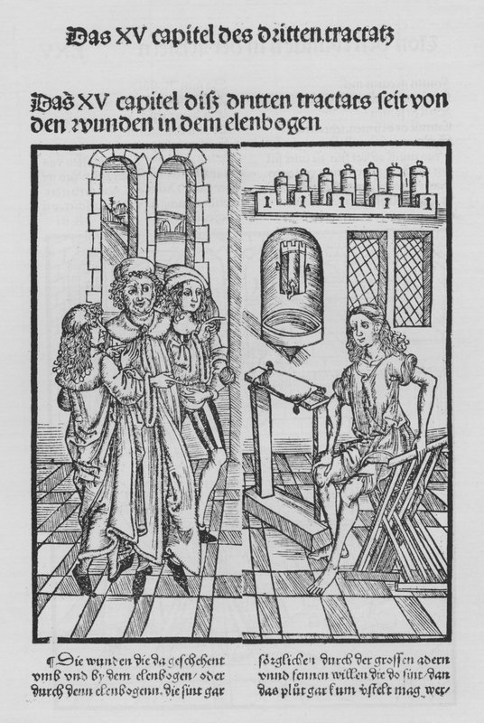 The Book of Cirurgia af Hieronymus Brunschwig (litho) af (after) German School