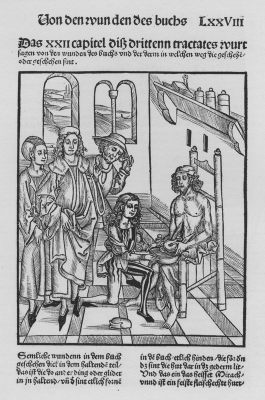 The Book of Cirurgia af Hieronymus Brunschwig (litho) af (after) German School