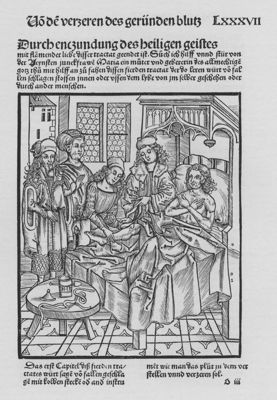 The Book of Cirurgia af Hieronymus Brunschwig (litho) af (after) German School