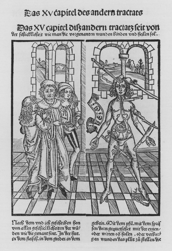 The Book of Cirurgia af Hieronymus Brunschwig (litho) af (after) German School