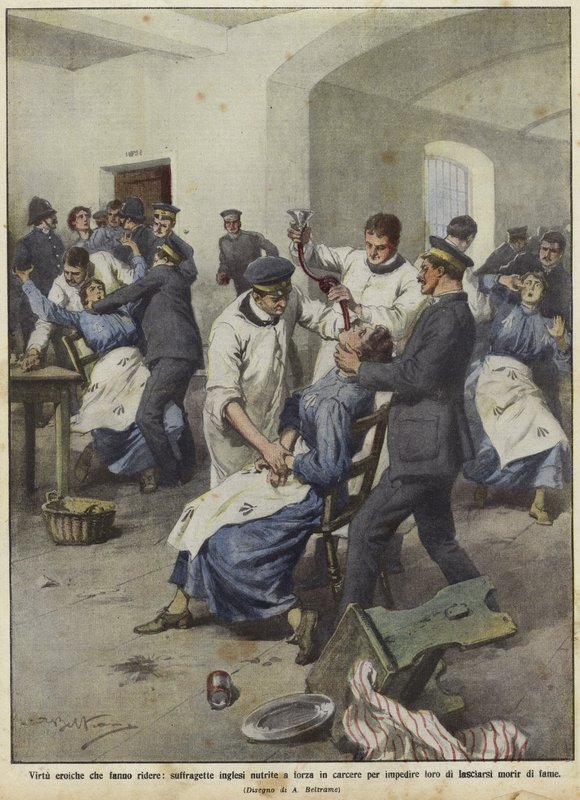 Britiske suffragetter bliver tvangsfodret i fængsler af Achille Beltrame