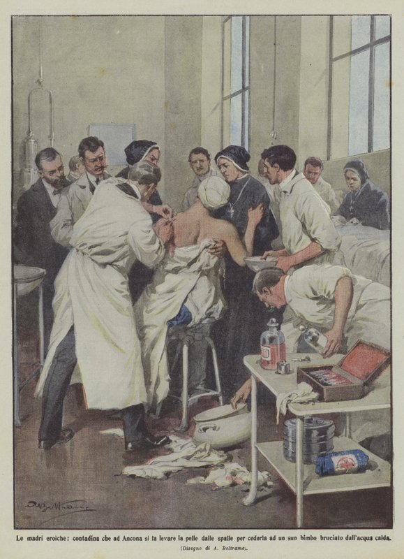 Heltemodige mødre, en bondepige i Ancona, der får fjernet sin hud fra skuldrene for at give den til en af sine egne? af Achille Beltrame