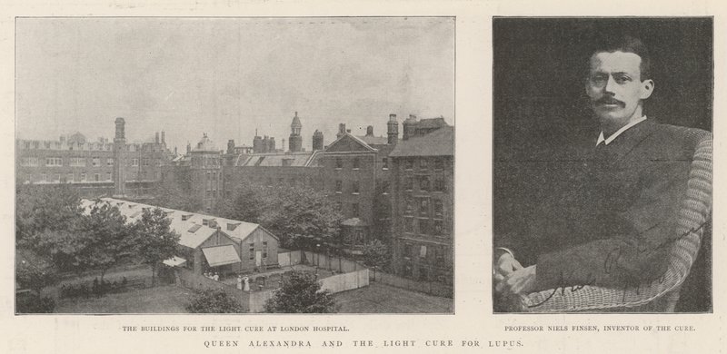 Dronning Alexandra og lyskuren mod lupus af English Photographer
