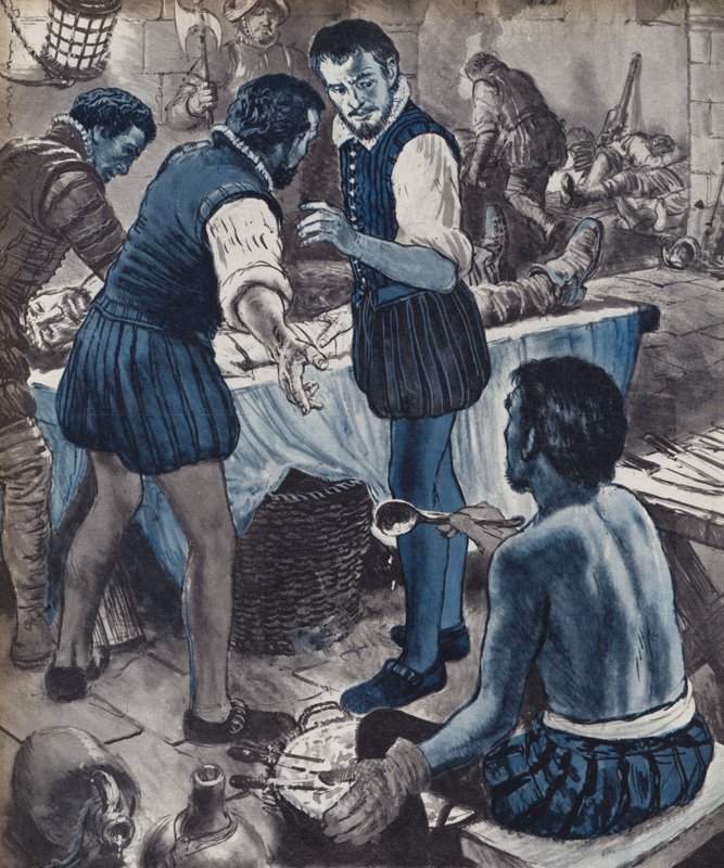 Ambroise Pare, militærkirurg, da olien løb tør (litho) af English School