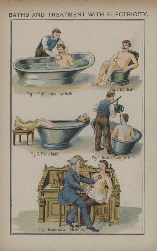 Bade og behandling med elektricitet (farve litho) af English School