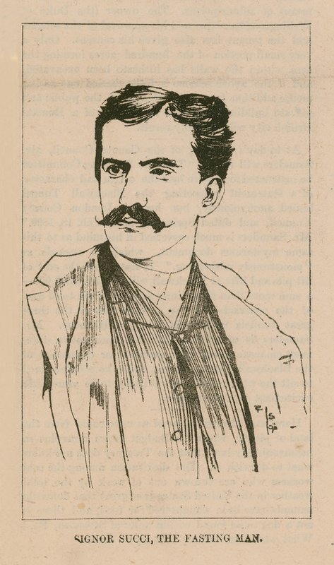 Portræt af Signor Giovanni Succi af English School
