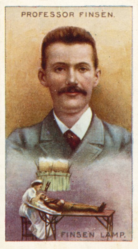 Professor Finsen, Finsen Lampe af English School
