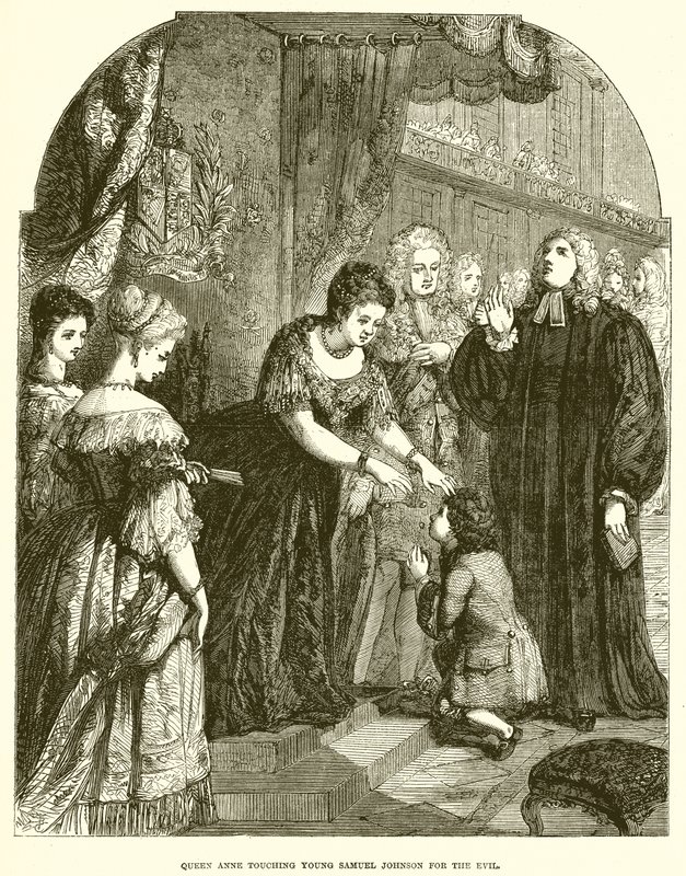 Dronning Anne rører unge Samuel Johnson for det onde af English School