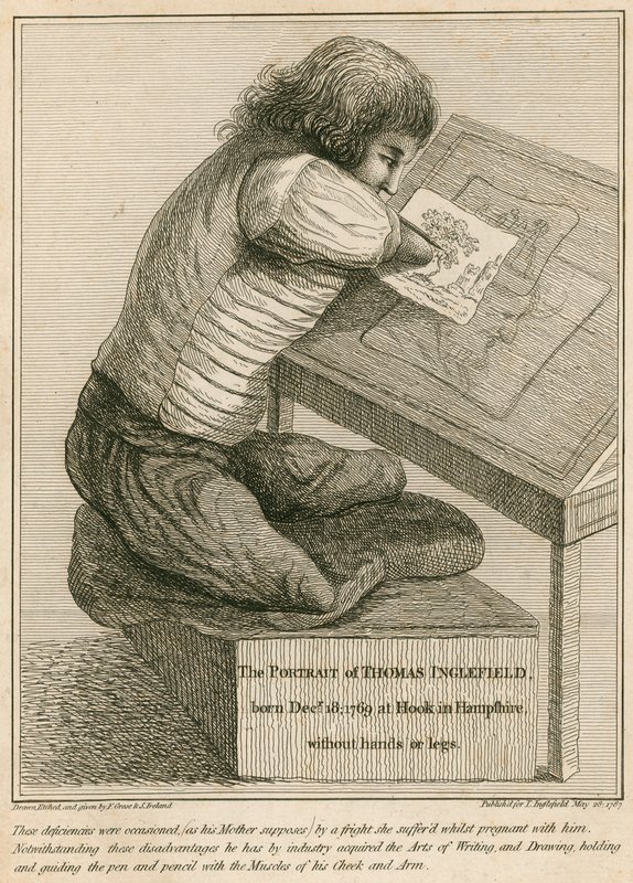 Thomas Inglefield, født 18. december 1769 i Hook, Hampshire, uden arme eller ben af English School