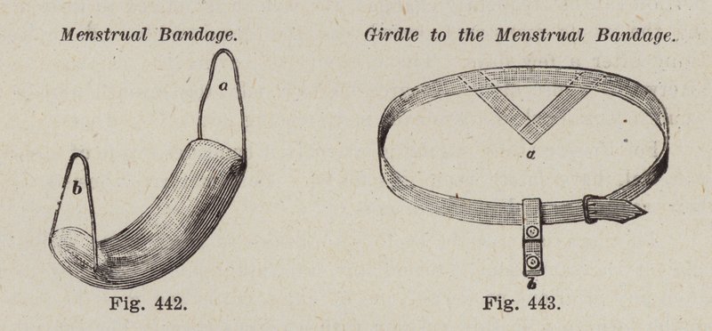 Menstruationsbandage; Bælte til menstruationsbandagen (litho) af European School