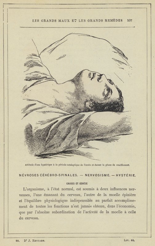 En hysterikers holdning i den kataleptiske periode af adgangen og under korsfæstelsesfasen (farve litho) af French School