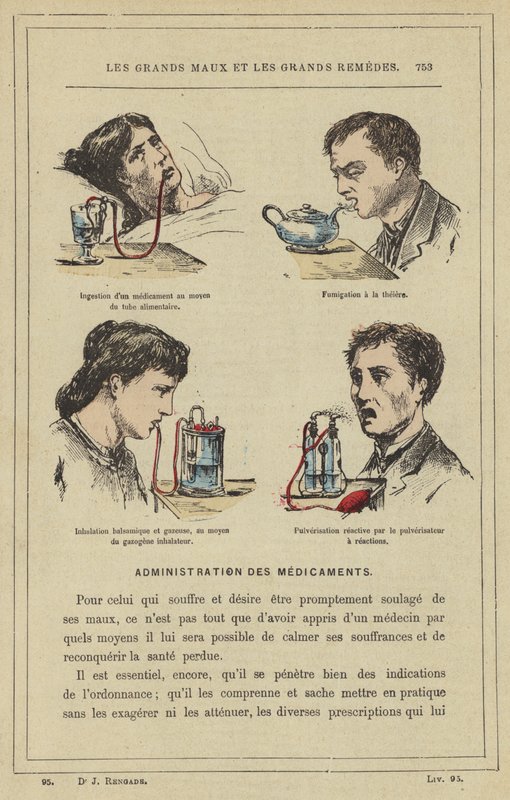 Indtagelse af et lægemiddel ved hjælp af madrøret, Røgning med tepotten, Balsamico og gasformig indånding, ved hjælp af inhalatorforgasseren, Reaktiv sprøjtning med reaktionssprøjten (farve litho) af French School