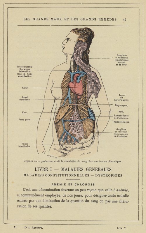 Organer for blodproduktion og cirkulation hos en klorotisk kvinde (farve litho) af French School