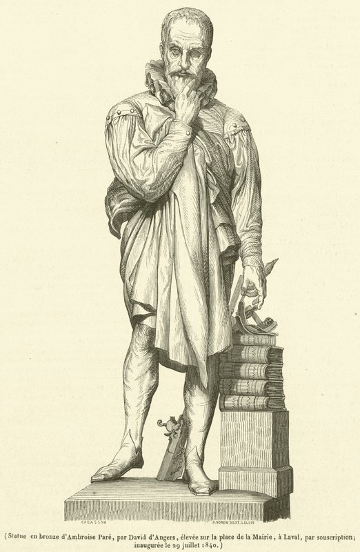 Bronzestatue af Ambroise Pare (gravering) af French School